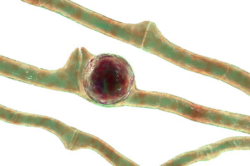 Wall Mural - Basidiobolus ranarum microscopic fungi, 3D illustration. Cause chronic inflammatory subcutaneous mucormycosis