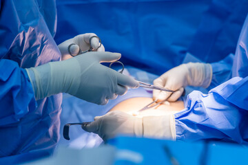 Wall Mural - A surgeon or Doctor with nurse team in blue uniform did surgery inside operating room in hospital.Surgeon holding surgical clamps and medical equipment with light.Emergency surgery was done.