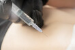 © mtrlin - Close up of cosmetologist makes injections to burn fat on the stomach and waist of a woman. Female aesthetic cosmetology in a beauty salon.Cosmetology