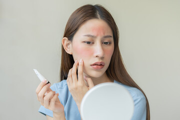 Wall Mural - Dermatology, asian young woman looking at mirror, holding cream tube in hand, expression worry and itch, itchy allergy or allergic sensitive reaction, red or rash on face. Beauty care of skin problem