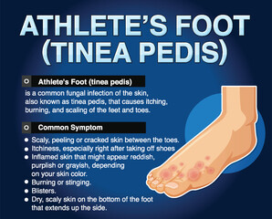 Canvas Print - Informative poster of Athlete foot