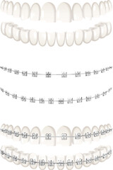 Sticker - Teeth Braces Set