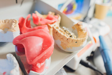 The process of making a dental prosthesis in a dental laboratory.