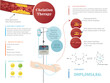 Infographic: Elimination of heavy metals and toxins in the blood by chelation treatment, explanation of the treatment in graphic form.