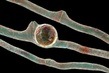 Wall Mural - Basidiobolus ranarum microscopic fungi, 3D illustration. Cause chronic inflammatory subcutaneous mucormycosis