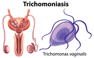 Poster - Trichomonas vaginalis on white background