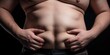 Male hands hold excessive fat on stomach close up, concept of Obesity, created with Generative AI technology
