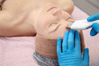 Dermatological doctor hands covered in gloves using Hydrafacial peel machine with spatula hand piece. Sanitation spa