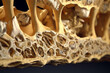 Magnified View of Bone Structure Under the Microscope