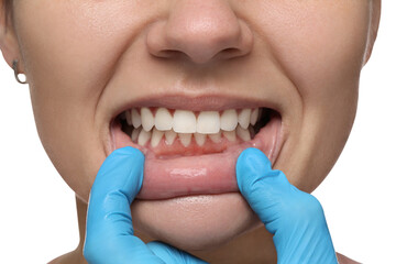 Sticker - Woman showing healthy gums on white background, closeup