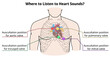 © alfa md - Where to listen to heart sounds? - Auscultation Position of Heart Valve - Vector Medical Illustration