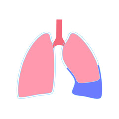 Sticker - Pleural effusion poster