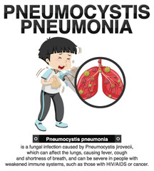 Canvas Print - Informative poster of Pneumocystis Pneumonia