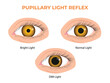 Pupillary light reflex PLR or photopupillary reflex
