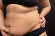 © Юля Бурмистрова - Female hanging belly with fat folds closeup. Overweight woman massaging stomach with hands. Studio portrait over black background. Plus size people. Concept of obesity, body positive, self acceptance.