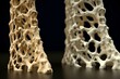 healthy boneand and osteoporosis bone - direct comparison - 3D Rendering. Generative AI