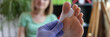 © megaflopp - Orthopedist examines leg with hallux valgus deformity of big toe