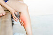 Women have leg or calf pain. Concept of health problems.