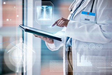 Leinwandbilder - Doctor, woman with tablet in hands and hologram with medical data, anatomy and lung x ray with overlay. Technology research in healthcare, futuristic and analytics with person and wireless tech