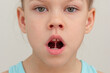 © Tatiana Foxy - Child face with tongue on upper palate in mouth cropped head caucasian little girl of 6 7 years on grey background