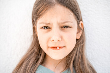 Charming smiling little girl kid with opened mouth shows staggering loose falling out first baby milk front tooth. Preschooler teeth changing. Healthy dental hygiene. Lost tooth. Dentist treatment