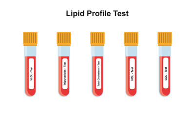 Wall Mural - Lipid Profile Test Concept Design. Vector Illustration.