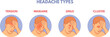 © ssstocker - Headache types. Headaches areas infographic diagram medical poster, brain pain type in head sinus migraine tension or cluster, anatomy part of hospital patient vector illustration