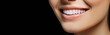 © Olga - Close up of smile with white healthy teeth on black background. Dental care. Dentistry concept.Banner