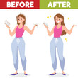 Woman before and after hair loss treatment or hair transplantation, flat vector.
