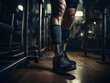 © Micro2ndDesigns - Legs of an amputee, labor, work,