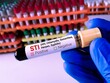 © Saiful52 - Biochemist or Lab Technologist holds Blood sample for STI or Sexually Transmitted Infection Test with laboratory background.