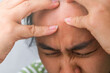 © Pornpimon - Young woman having headache against white curtain background in room. An adult woman touching head because of headache or migraine. Hands on head.