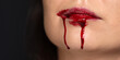 Close up of a woman's lips with blood dripping from her mouth