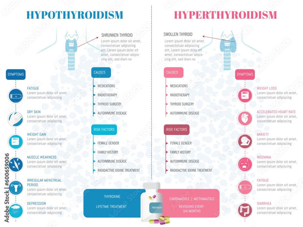 Comparative Infographic Of Two Thyroid Diseases Hypothyroidism And comparative-infographic-of-two-thyroid-diseases-hypothyroidism-and