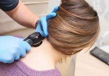 Dermatologist Examines A Mole On The Patient's Neck Using A Special Device - A Dermatoscope. Prevention Of Skin Cancer - Melanoma.
