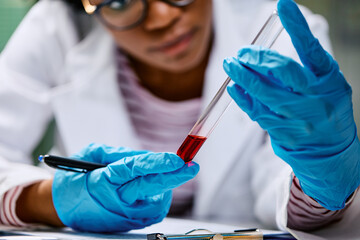 Wall Mural - Close up of female lab technician analyzing liquid in test tube.