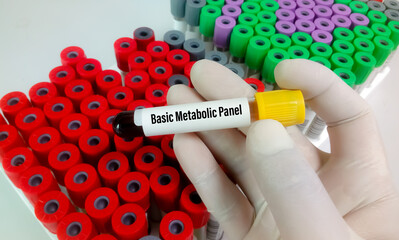 Wall Mural - Scientist hold blood sample for basic metabolic panel test