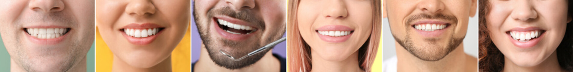 Poster - Collage of many people with healthy teeth, closeup