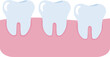© Ekky - Vector illustration of teeth and gums