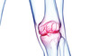 3d medical illustration of knee pain