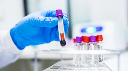 Hand of scientist or laboratory technician with blue medical glove inside lab room in hospital or clinic.Blood tube in blood donation bank for patient.Blood group matching analysis technology.