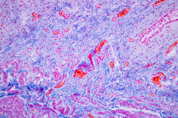 Wall Mural - Histological Smooth muscle human under the microscope for education.