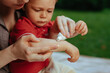 Mother puts cream on baby's hand in summer