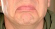 © Alena - Close-up part of the man's face, the chin is shaking, the beginning of the emotion to cry. The lips and chin are shaking. Sudden change of mood smile. An illustration of a bipolar state.
