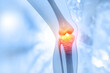 Pain in knee joint. Tendon problems and Joint inflammation on medical background. 3d illustration