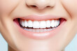Tooth whitening, perfect white teeth close up, female toothy veneer smile, dental care and stomatology, dentistry. generative ai.