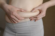 © GRON777 - A fat woman in white trousers touches the fat folds on her stomach, close-up.Lifestyle,diet concept,weight loss,obesity.