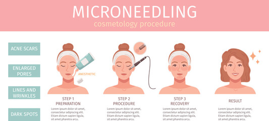 Canvas Print - Cosmetology Procedures Infographics