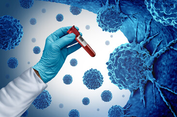 Wall Mural - multi cancer blood test and screening for early detection of cancers and malignant cells as carcinog