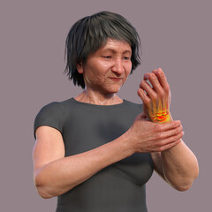 Poster - A woman experiencing wrist pain, 3D illustration